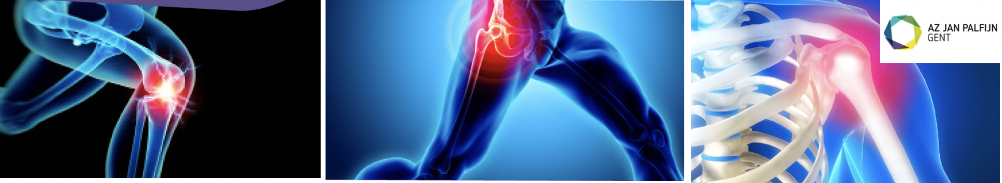 Rapid Recovery programma na gewrichtsvervanging