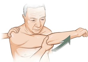 Klinische test voor AC-gewrichtsartrose