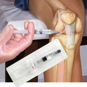 Schéma de la procédure d'injection d'acide hyaluronique