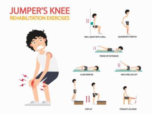 Jumper'ın dizi için rehabilitasyon egzersizleri